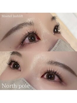 ノースポール(north pole)/メーテルラッシュリフト