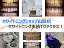 ホワイトニングショップ 山科店