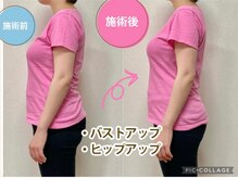 骨盤整体 サクラ(Sakura)/ビフォーアフター/産後骨盤矯正