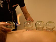 錦の雰囲気(カッピングで疲れ解消◎肩こりや冷え改善したい方におすすめ♪)