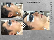 ル シャの雰囲気（男性リピーター率９割/美肌光フェイシャル（あらゆる悩み改善））