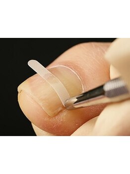 爪の悩みを解消できる（ケア含む）