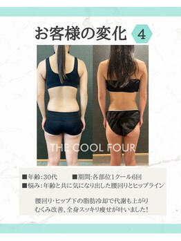 リッカロッカ(RIKKA&ROCCA)/脂肪冷却