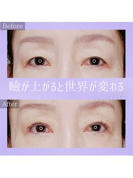 コトリ(kotori)/アイリッドアップパーマ