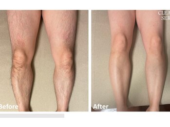 シズク ビューティーサロン(SHIZUKU beauty salon )/