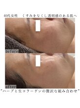 ヴェルシック(Belchic)/女性から人気の生コラーゲン