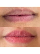 リュミエール デスポワール(Lumiere d'espoir)/ローマピンク