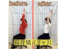 きずな鍼灸整骨院 武蔵ヶ丘本院/猫背矯正