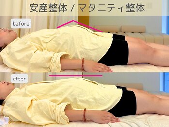 ムーム(moom)/マタニティ整体変化☆