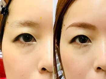 悠雅の写真/本格眉毛スタイリングに自信あり!!初回のカウンセリングを丁寧に行い、その人に合った眉をデザインします♪