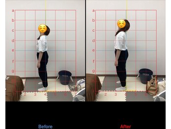 北春日部接骨院/産後骨盤　ビフォーアフター