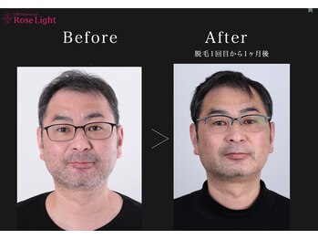 ヘルディン(heldin +555)の写真/《都度払い◎》全身・部分問わず、快適に通える次世代のLED脱毛◇レディース～メンズまで施術可！