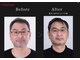 ヘルディン(heldin +555)の写真/《都度払い◎》全身・部分問わず、快適に通える次世代のLED脱毛◇レディース～メンズまで施術可！
