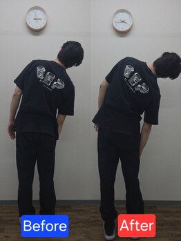 最後の整体 練馬駅前院/腰痛でお悩みの方の可動域