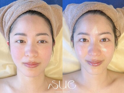 スー(Sue)の写真