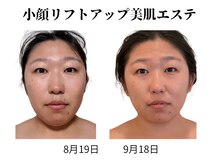 トータルボディケア きみんち