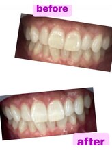 ホワイトマジック(White Magic)/beforeafter