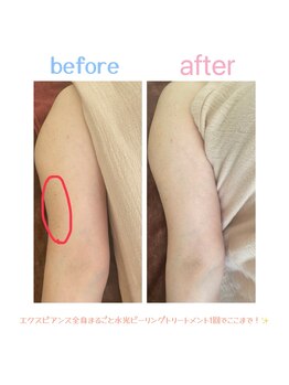 タイカ(Taika)/全身ピーリング