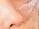 サロンドール(Salon doll)の写真/《都度払い/好きなときに通いやすい♪》気になる毛穴汚れをしっかり洗浄!!お肌悩み別のお得なクーポンも◎