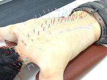 とだ鍼灸院/一日中、いすに座って腰が痛い！