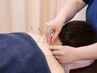 【鍼灸肩コリ・腰痛特化SPコース◎】鍼灸＋全身整体　45分6500円→