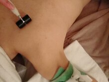 ホワイトカメリア(White Camellia)/ブライダルケア/背中シミケア