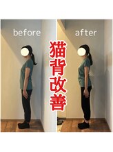 カーム 天白区野並(calm)/整体ビフォーアフター