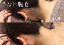 セレ(Cele)