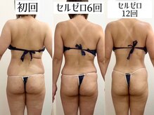 フローレンス(Florence)の雰囲気（セルライトゼロで脂肪燃焼撃退形まで綺麗に痩せることができる）