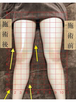 リヘッド(Re.head)/ハイパーナイフEX 下半身集中