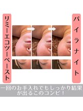 ラ ルミエール(La Lumiere)/頬が固くて丸顔の方へもおススメ