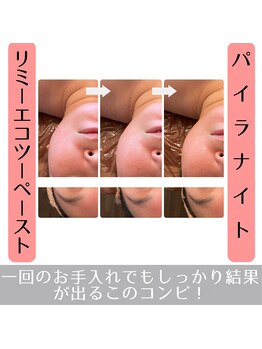 ラ ルミエール(La Lumiere)/頬が固くて丸顔の方へもおススメ