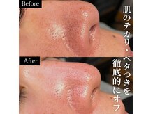 ラフ(LaFF)の雰囲気（黒ずみ・皮脂汚れも美容液で洗う毛穴洗浄で誰もが羨む美肌へ！）