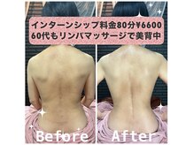 エステティックサロン ラ アクア(ra aqua)の雰囲気（【土日限定】インターン生のトリートメント5／10からご予約可能）