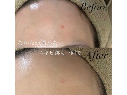 ベル(Belle)の写真