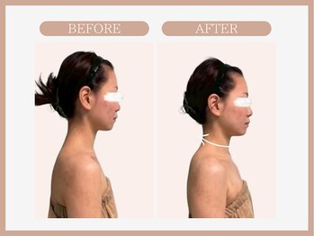 スリムライン 八戸店(The Slim Line)/before→after