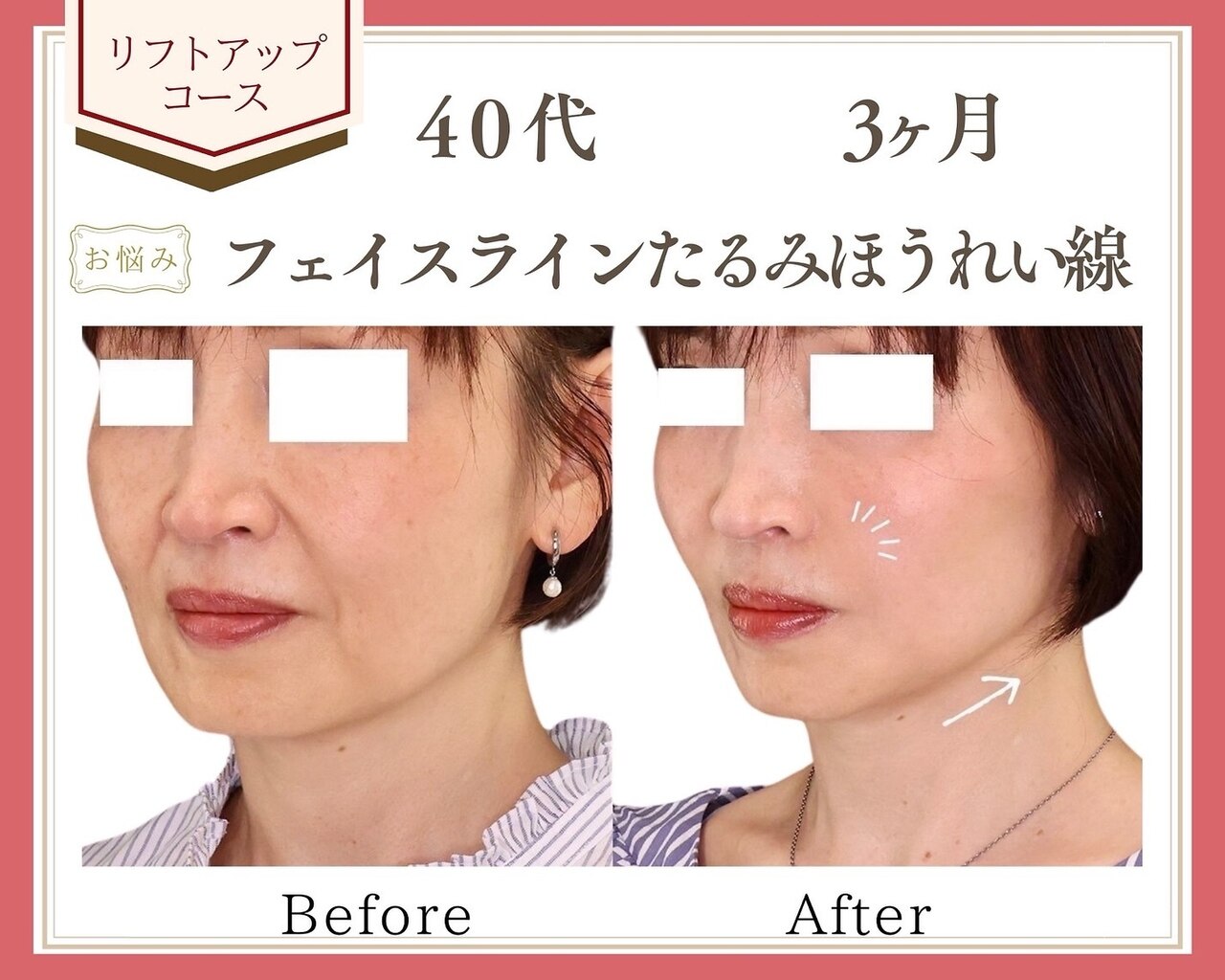 リュミエール(Lumiere)｜ホットペッパービューティー