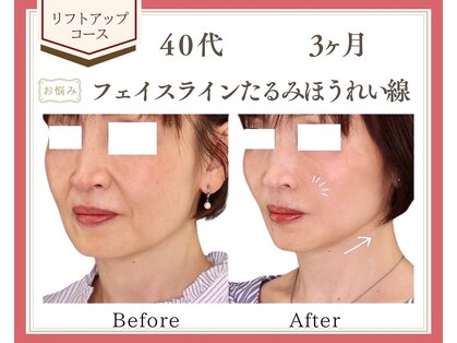 リュミエール(Lumiere)の写真