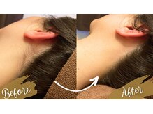 チャンティック(Cantik)/うなじケア