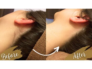 チャンティック(Cantik)/うなじケア