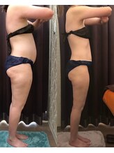 ビーシェイプ 君津(B-Shape)/【痩身】ビフォーアフター