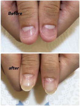 モアニヒロオ 広尾駅前店(MOANI Hiroo)/【深爪育成】