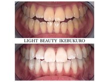 ライトビューティー 池袋店(LightBeauty)/症例写真
