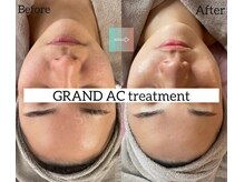 サザンベル(Southern Belle)/グランACトリートメント