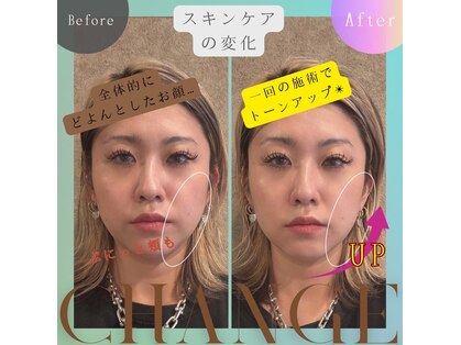 レジオス 名古屋丸の内店(Regios)の写真