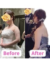 ボディキュア ブライダル美容整体 大阪梅田/【二の腕ケア】見た目スッキリ