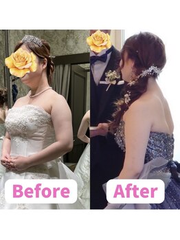 ボディキュア ブライダル美容整体 大阪梅田/【二の腕ケア】見た目スッキリ