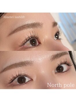 ノースポール(north pole)/メーテルラッシュリフト