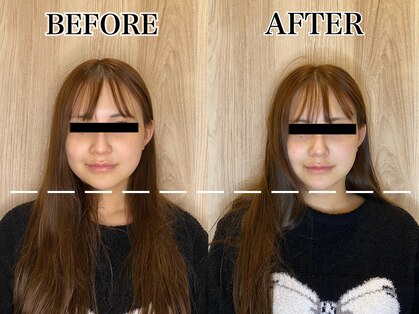 恵比寿駅前整骨院はり院 別館【美容鍼・鍼治療・整体】の写真