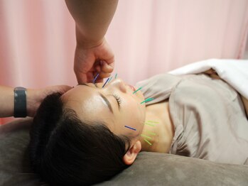 同心整体院の写真/筋肉を刺激し根本からアプローチ《美肌美容鍼30分¥2500～》むくみ改善　《小顔耳つぼジュエリー¥3000～》